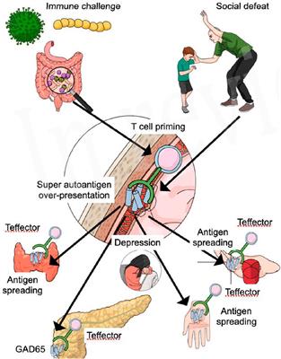 A new perspective of frozen shoulder pathology; the interplay between the brain and the immune system